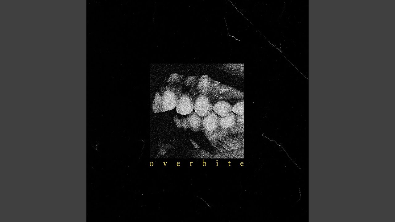 Overbite (Single Edit)
