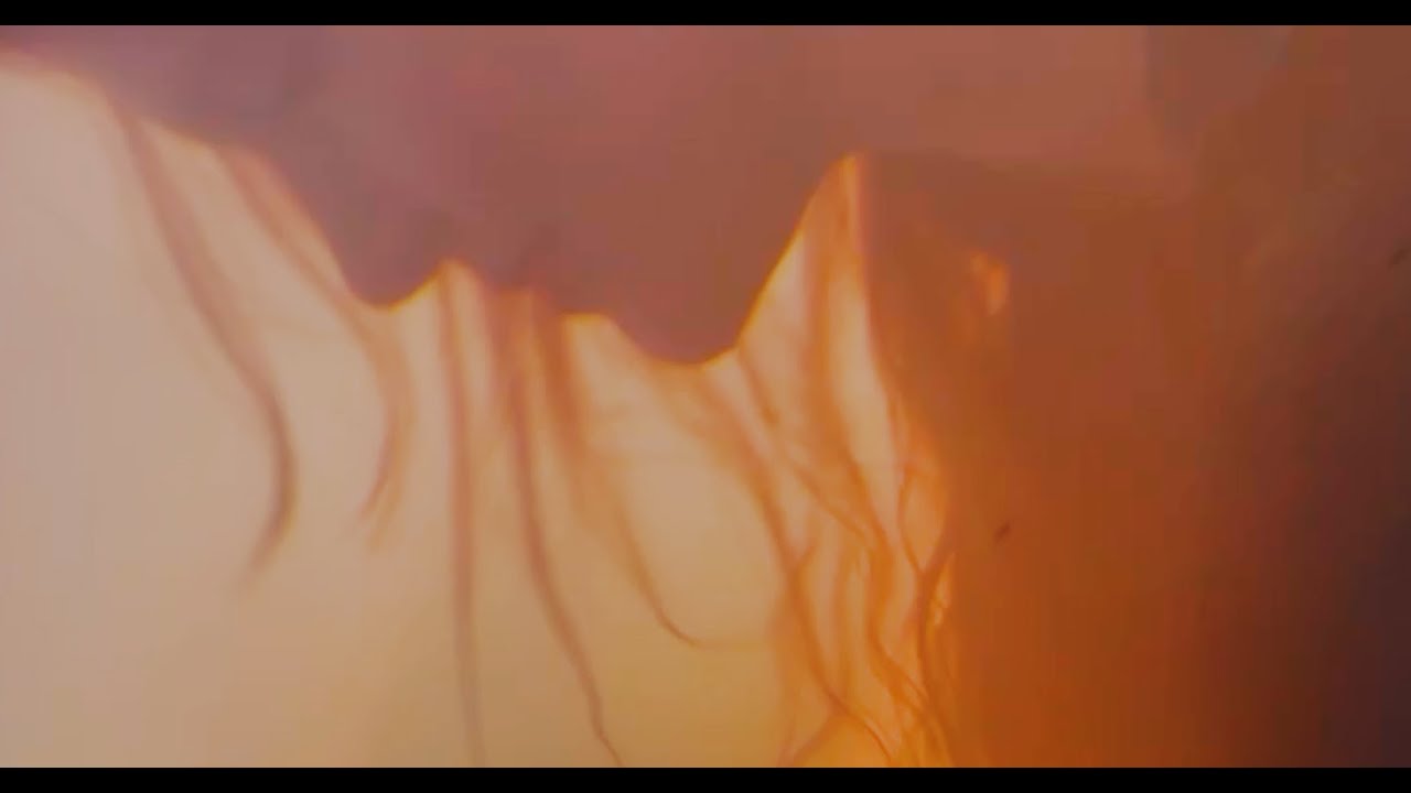 WOOM - Welts (Official Music Video)