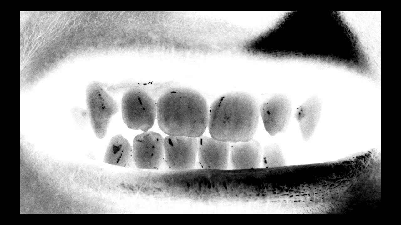Rhoshi - Fracture