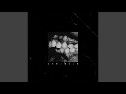 Overbite (Single Edit)